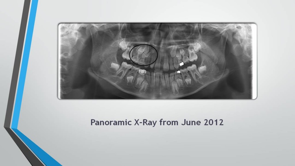 The importance of Panoramic XRays McSurdy Orthodontics