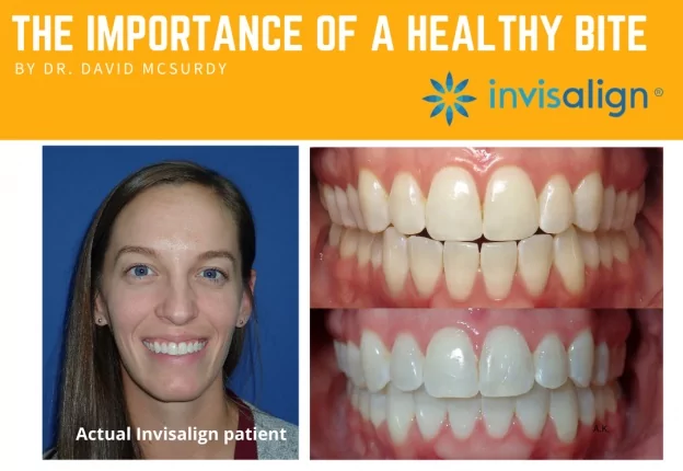 invisalign