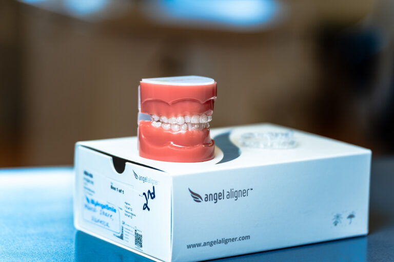 Model Of Angel Aligners